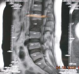 spine specialist amritsar