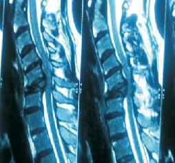 best spine doctor in pathankot