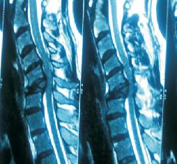 best spine doctor in jammu